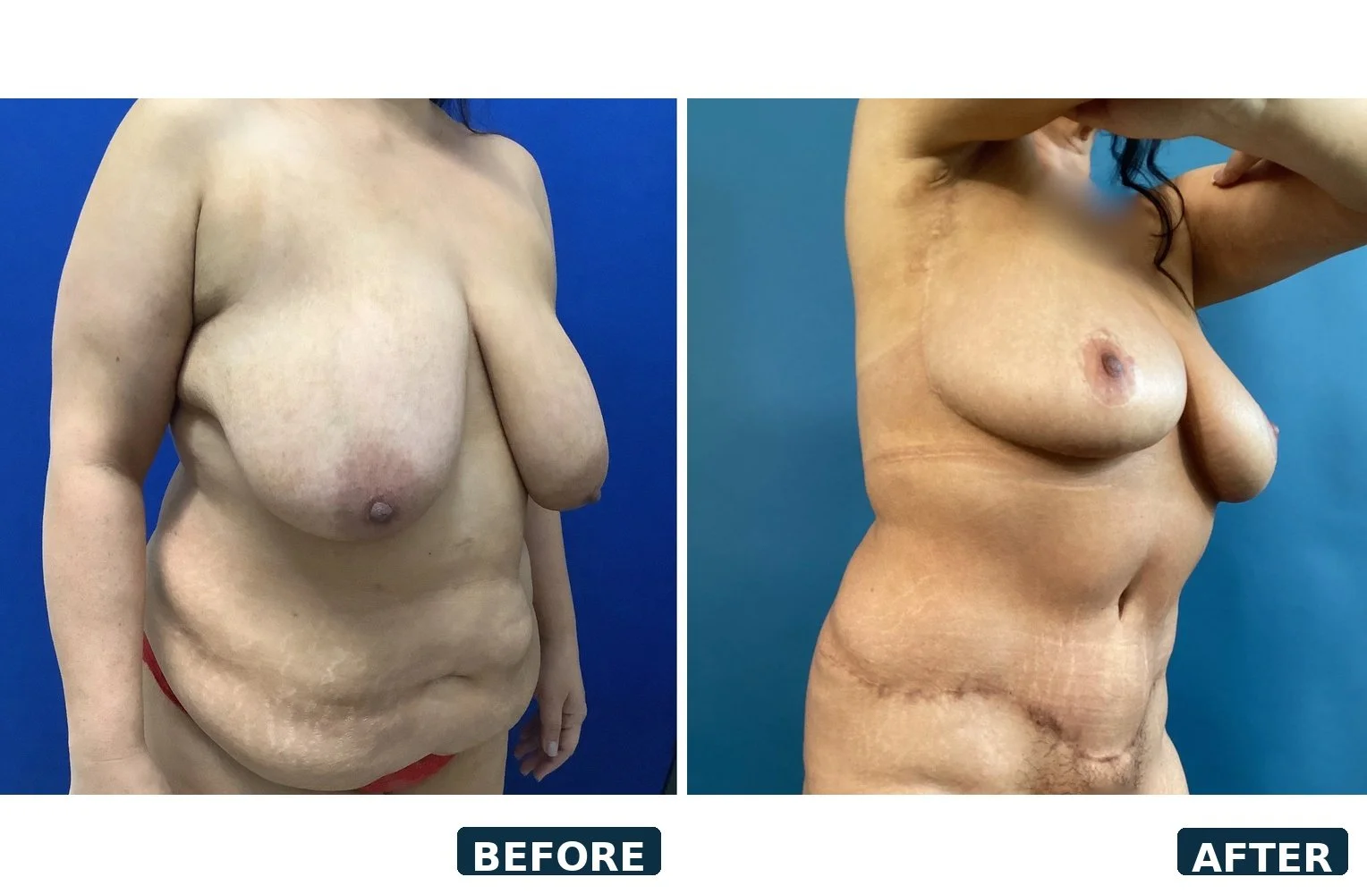 pearl-case-02-oblique-before-after-CLEAN.jpg