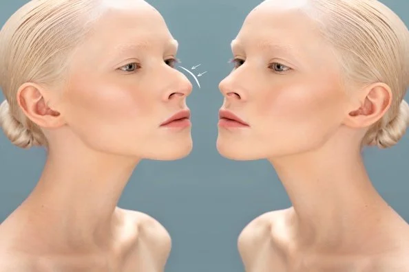 How Facial Proportions Influence Rhinoplasty Planning