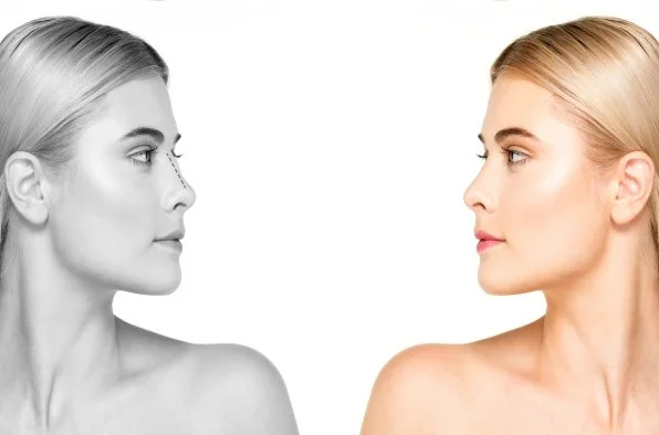 Functional vs Cosmetic Rhinoplasty: Understanding the Difference