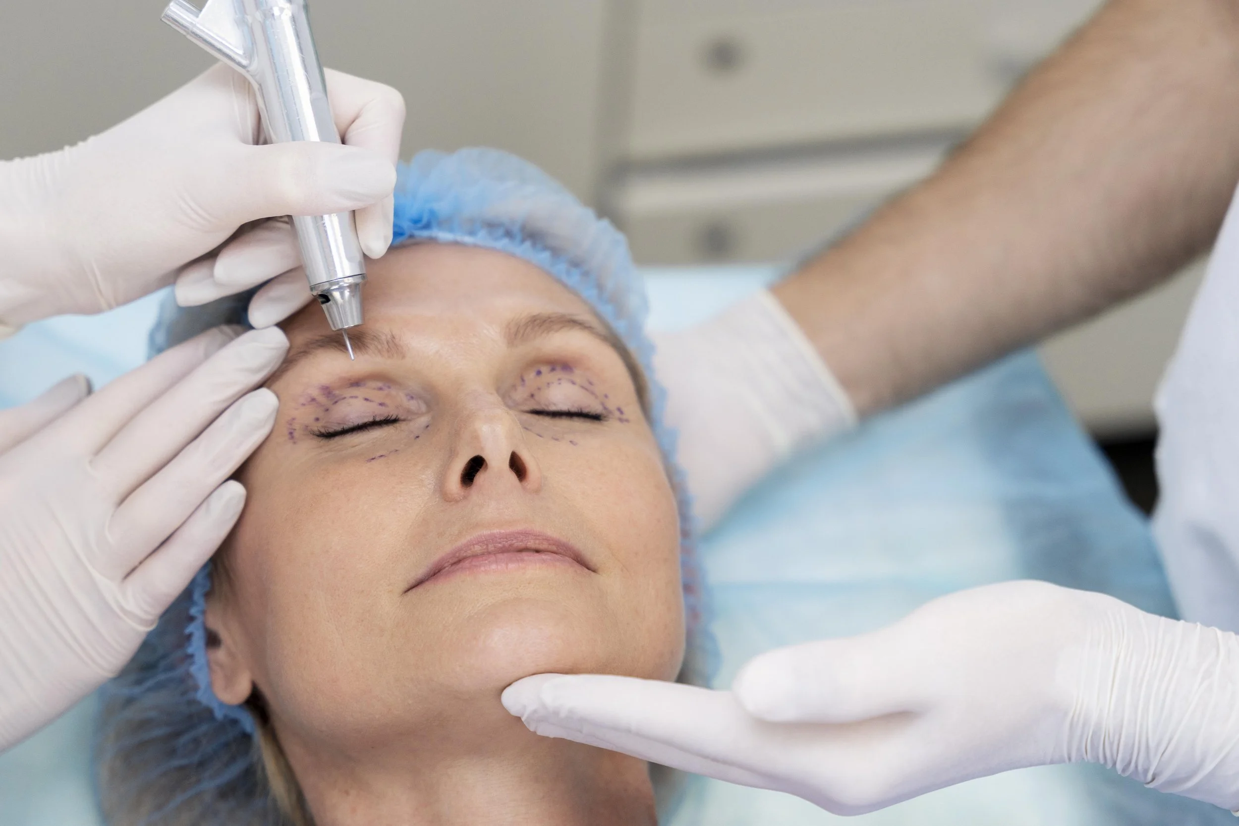 Why Upper Eyelid Surgery Is Often One of the First Rejuvenation Procedures