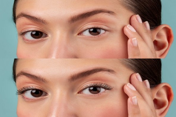 Makeup Challenges with Hooded Lids and Surgical Options