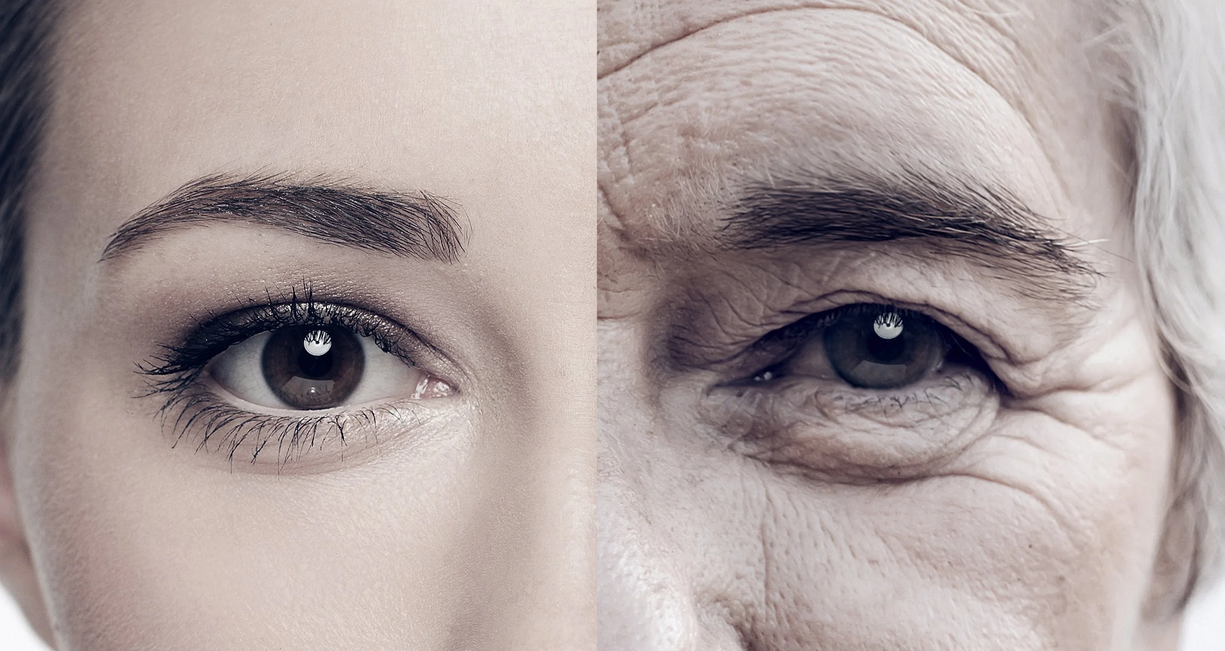 Aging Around the Eyes: Skin Laxity vs Fat Changes