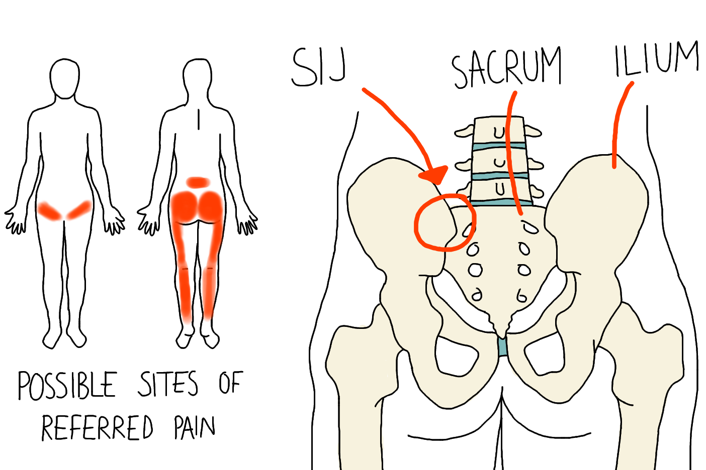 Understanding SI Joint Dysfunction: Causes, Symptoms, and Stabilization Exercises