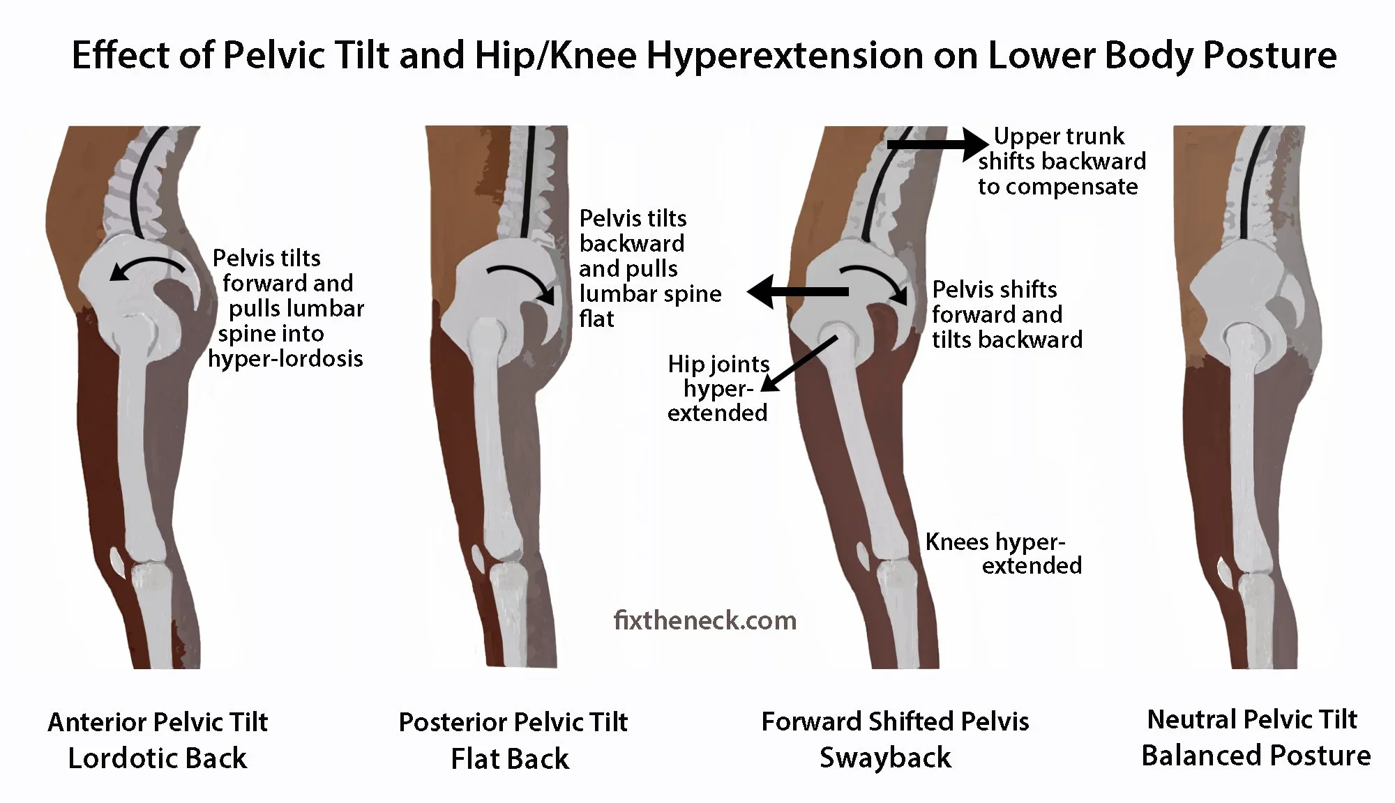 Understanding Pelvic Upslips, Downslips, and Pelvic Rotations