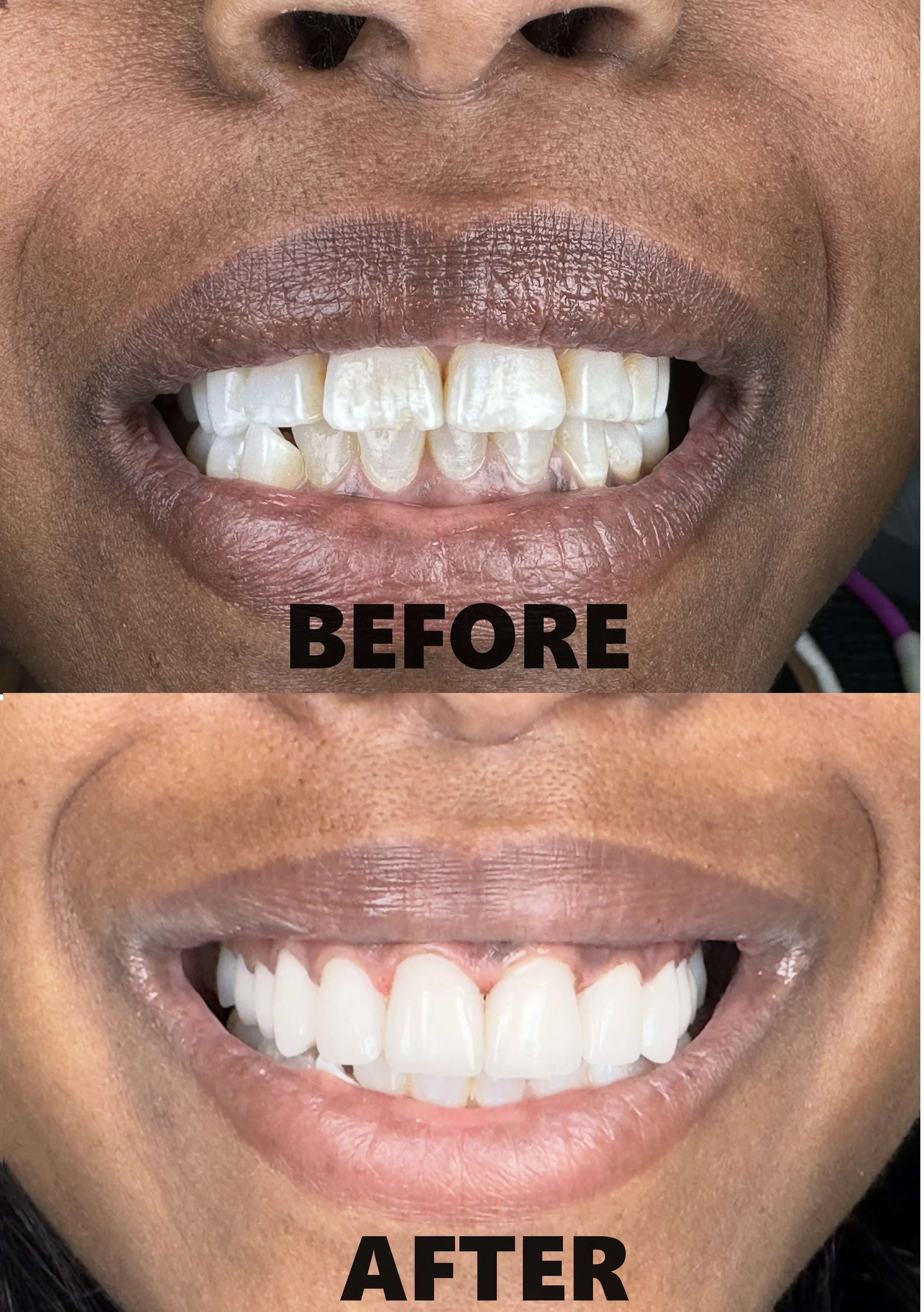 smile makeover 1.jpg