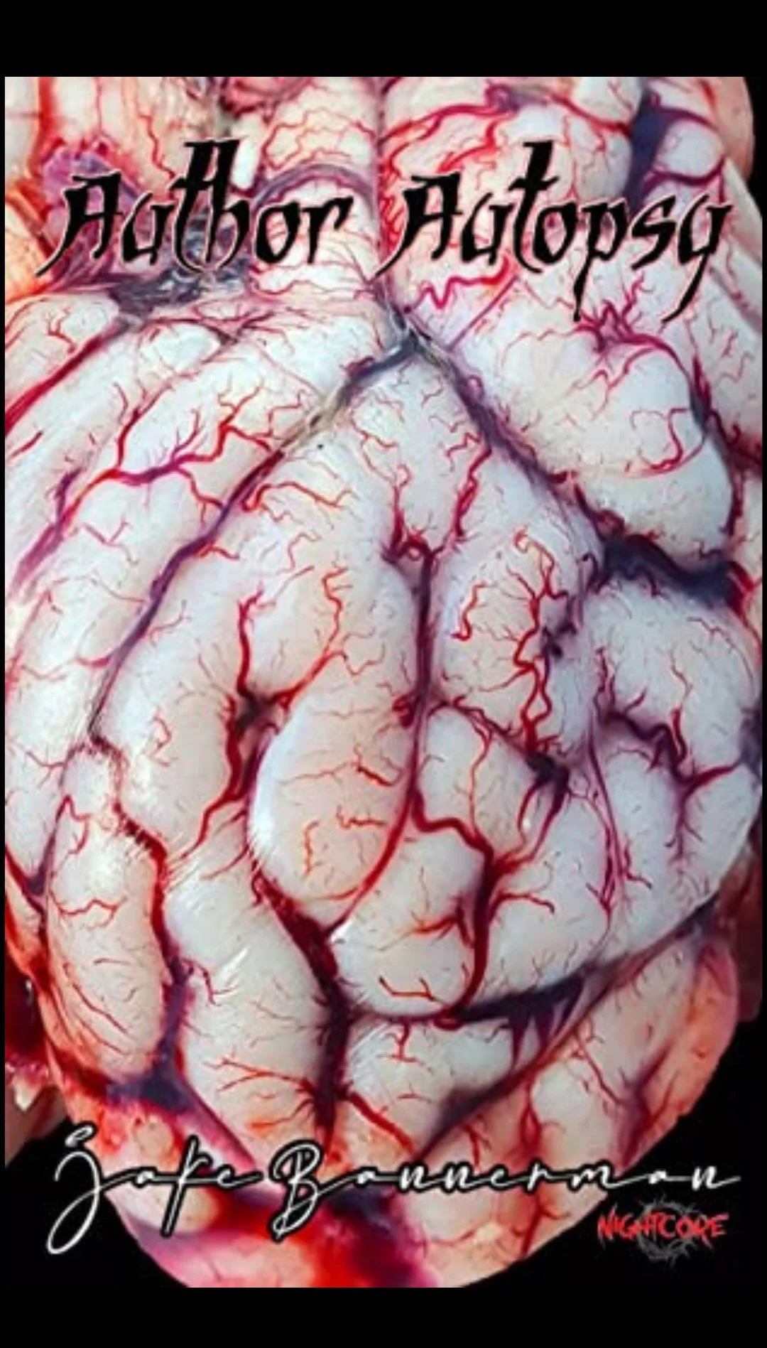 A close-up of a brain with prominent blood vessels, with the title 'Author Autopsy' and the author name in stylized text across the image, and the word 'Nightcore' in red at the bottom right corner.