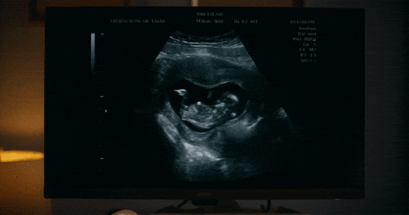 DOUBLE TROUBLE GIFS_5.gif