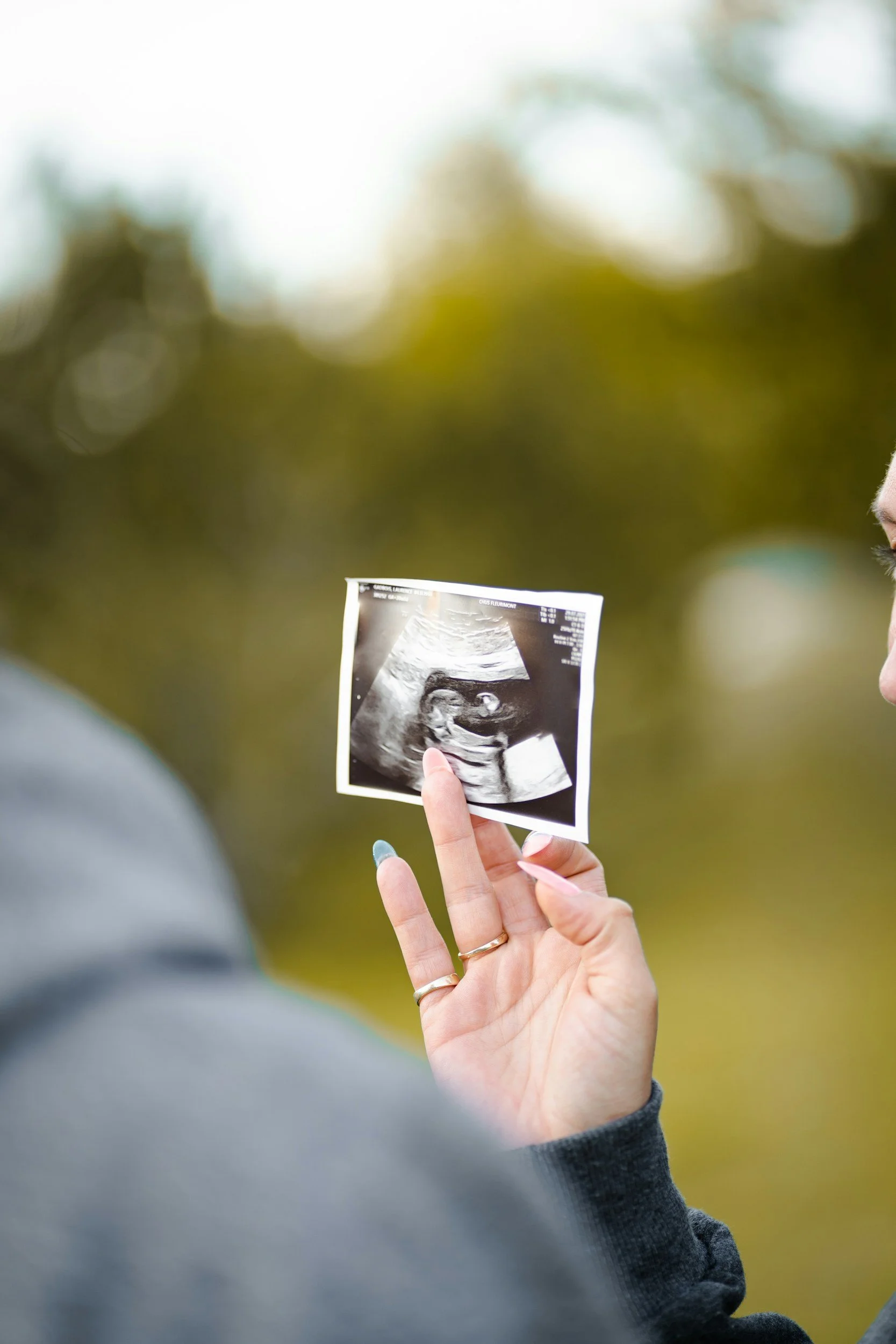 Person holding an ultrasound ultrasound image outdoors, with trees and blurred background.