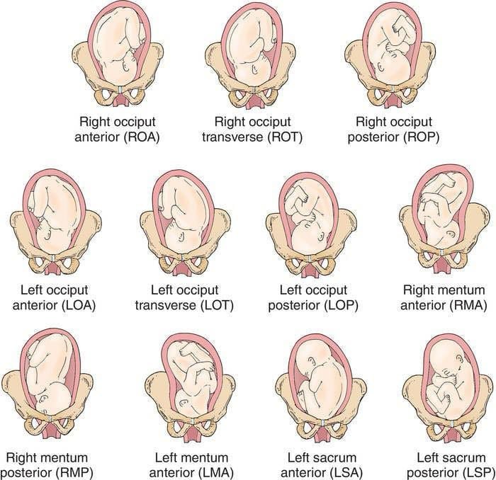 Fetal Positions