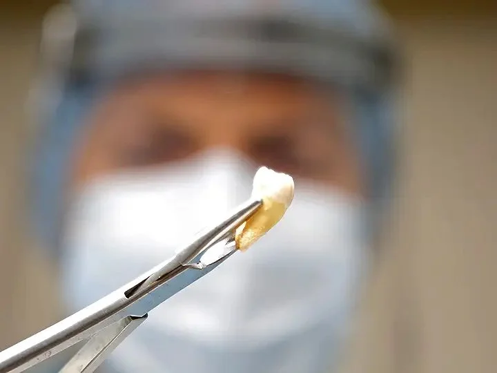 3. The Body in the Barrel