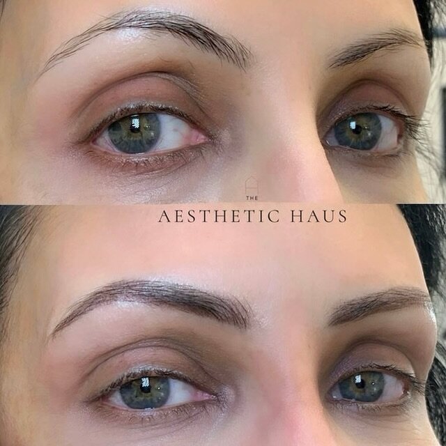 Unlike microblading, Powder Brows use a shading method to fill in sparse areas and enhance your natural arches. 

Say goodbye to daily brow makeup and hello to wake-up-and-go perfection! 

To book with @beautybysofiya - Click the link in our bio. 

.