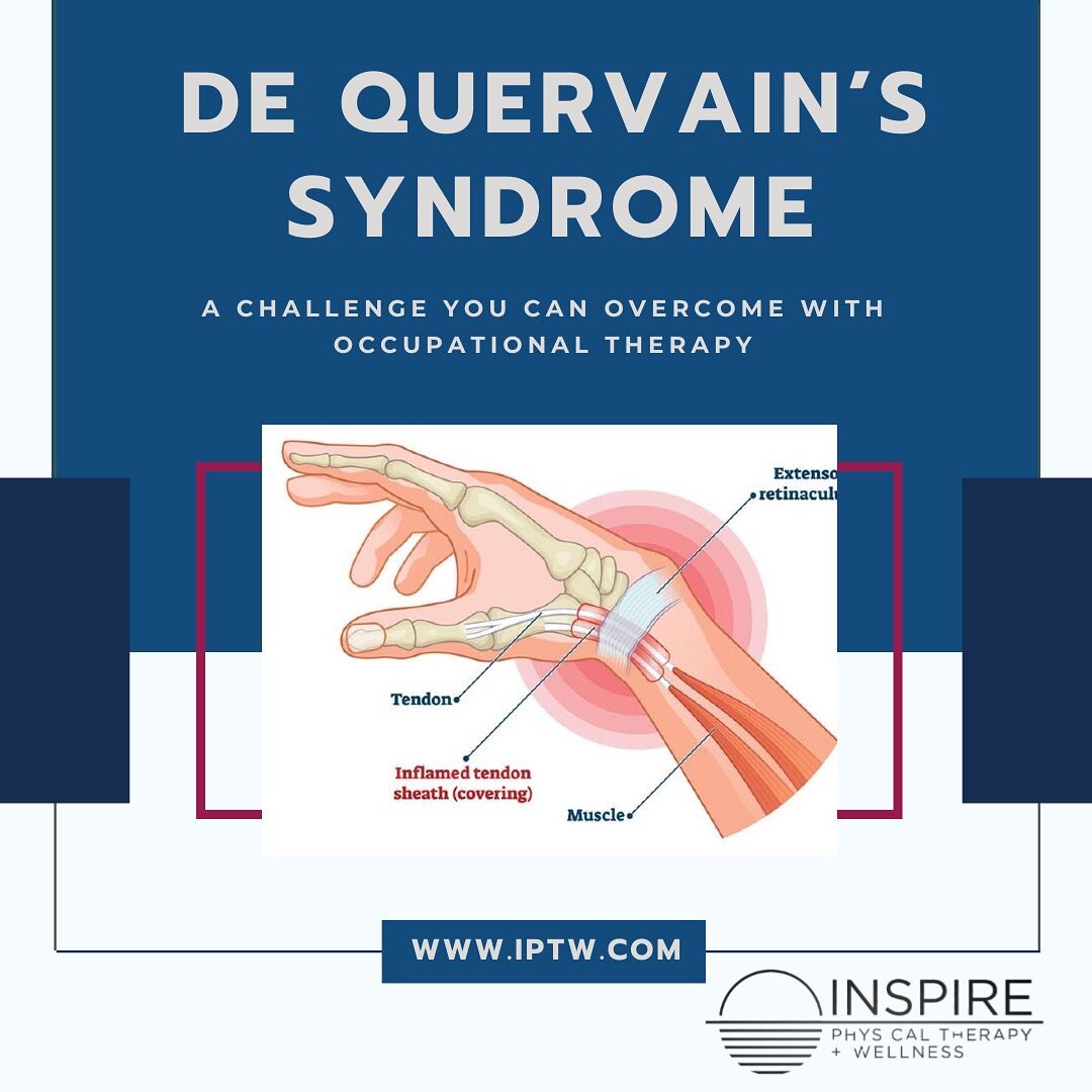 De Quervain&rsquo;s Syndrome is a painful condition affecting the thumb and wrist that can be alleviated with occupational therapy. 
.
OT focuses on exercises and techniques to improve hand function and reduce discomfort. 
.
If you&rsquo;re dealing w