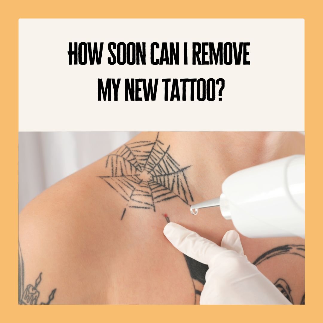 How can I speed up laser tattoo removal? - Blog - Aura Skin Institute