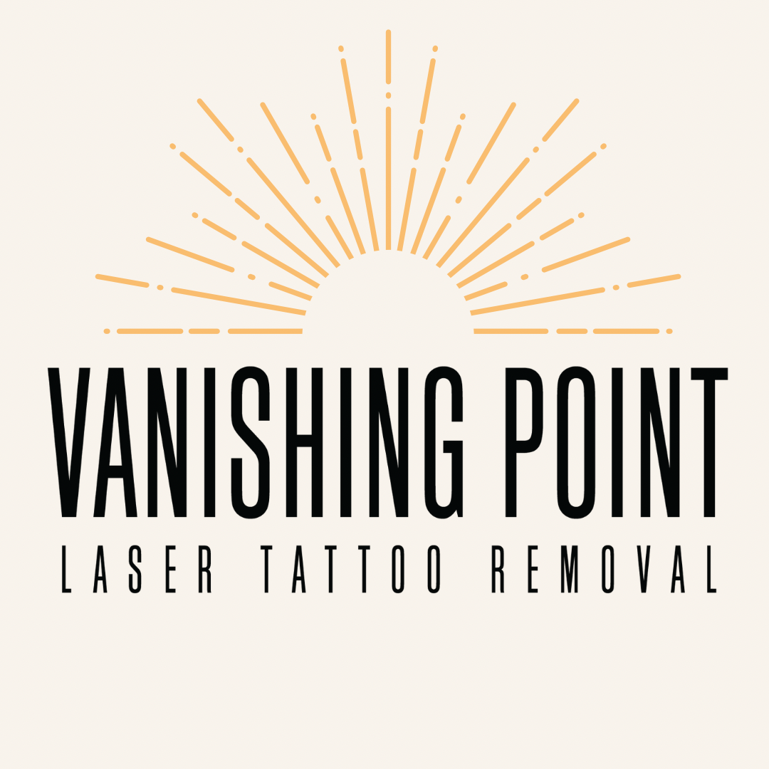 Vanishing Point Laser Tattoo Removal