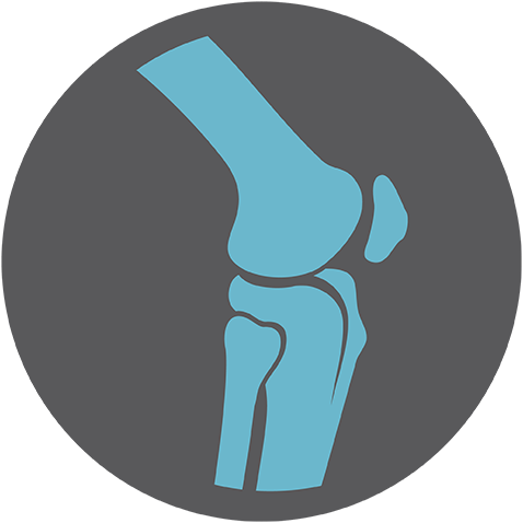 Joint Arthritis &amp; Limb Pain