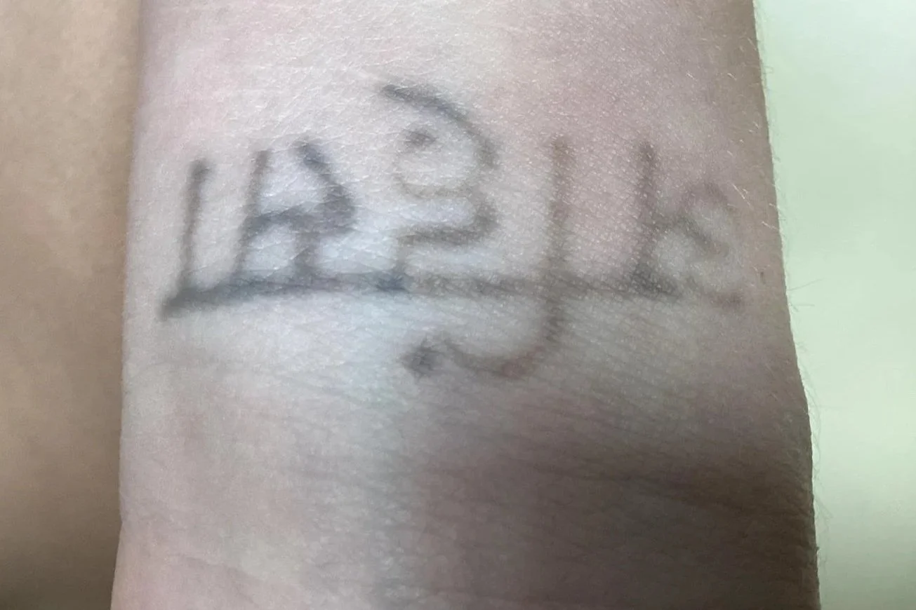 after 2 treatments
