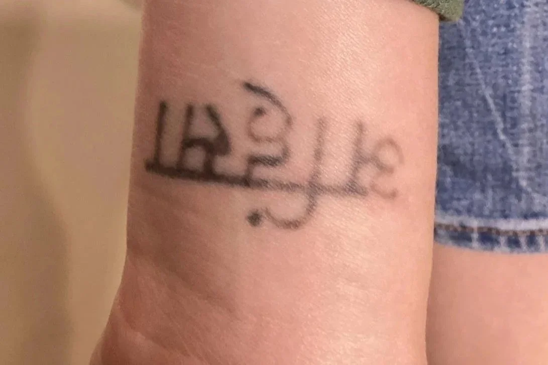 after 1 treatment