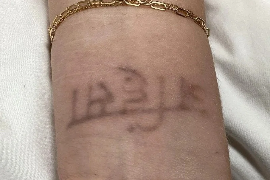 after 3 treatments