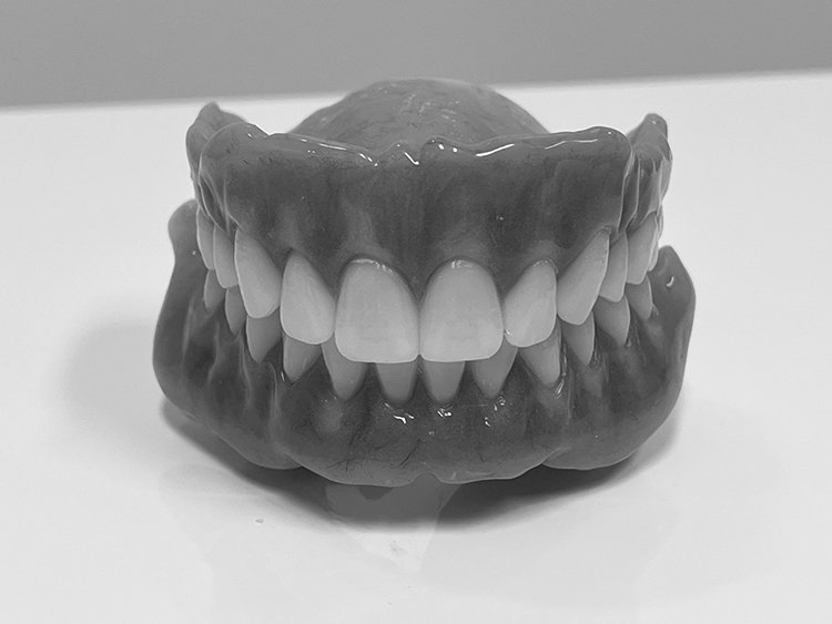 Denture is ready