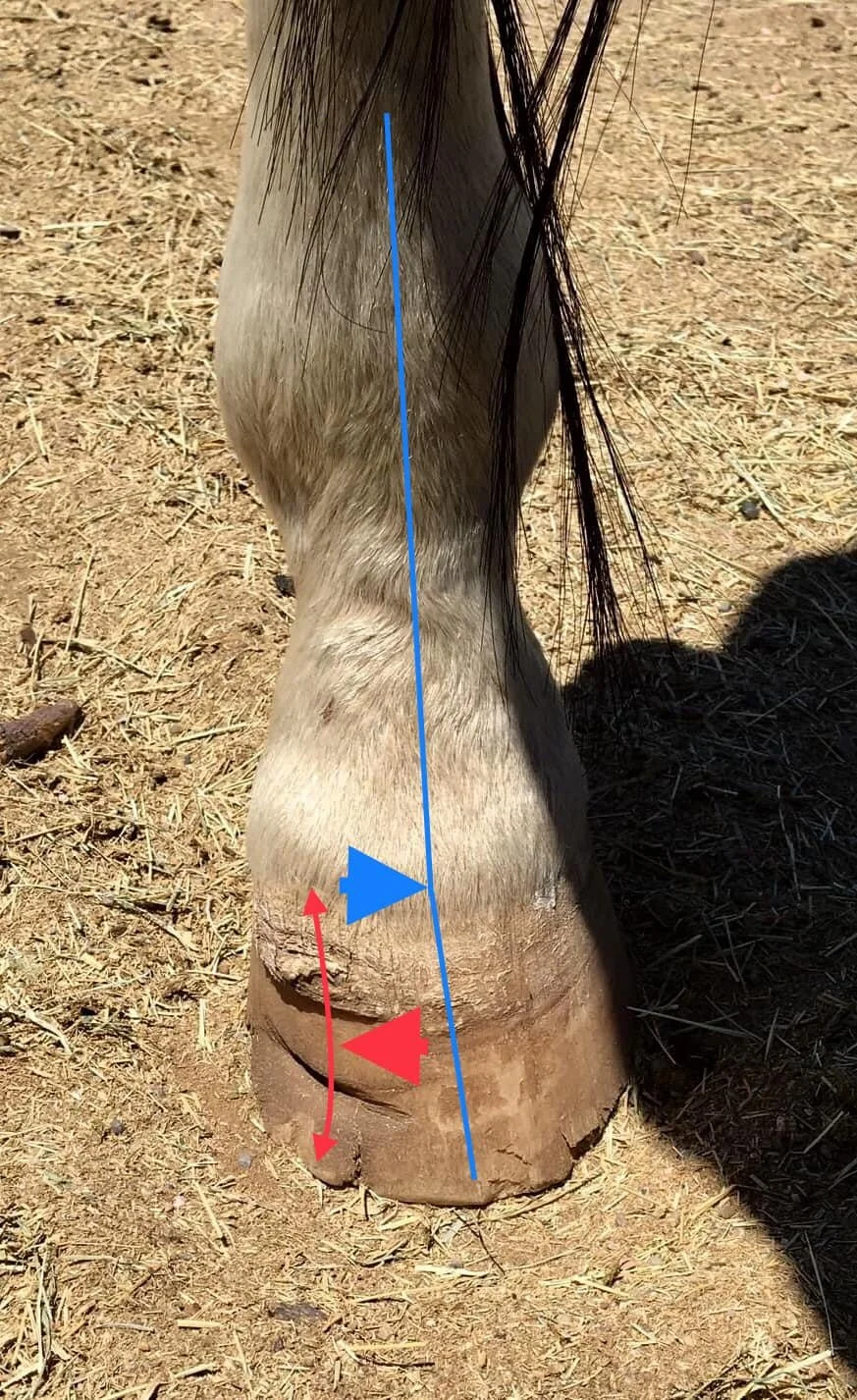 Markup showing leg coming down at an angle and breaking the line at the coffin joint ( blue ). The equal and opposite reaction in the hoof capsule ( red ). This causes, arthritis, P3 erosion, abscessing, wall flares, tendon/ligament strain, compensat