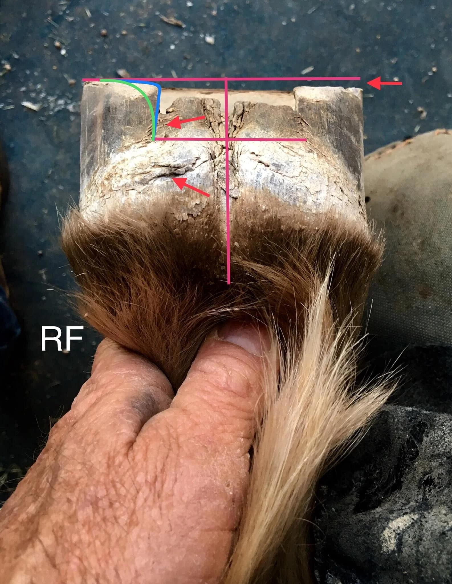 The heels were trimmed flat for the shoe and weren’t balanced properly to the leg. The medial heel is too long and starting to bend inward. This causes pinching where the hard horn meets the soft bulbs at the widest part of the frog where the collate