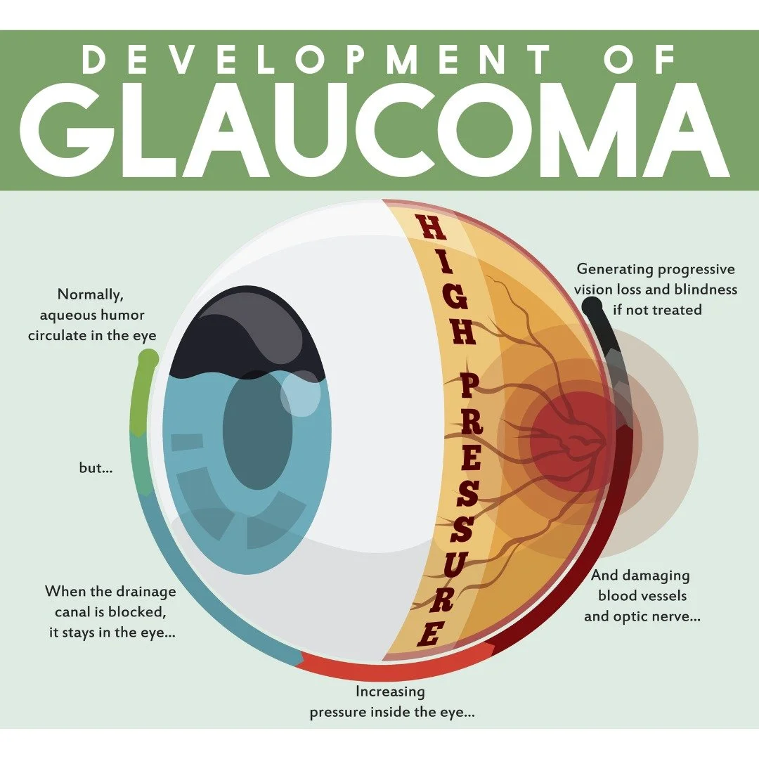 This week is World Glaucoma Week!

Glaucoma is the leading cause of preventable blindness. Most people with glaucoma are not aware of it as they may have no symptoms early on. 

The best way to catch it early is by having regular, comprehensive eye e