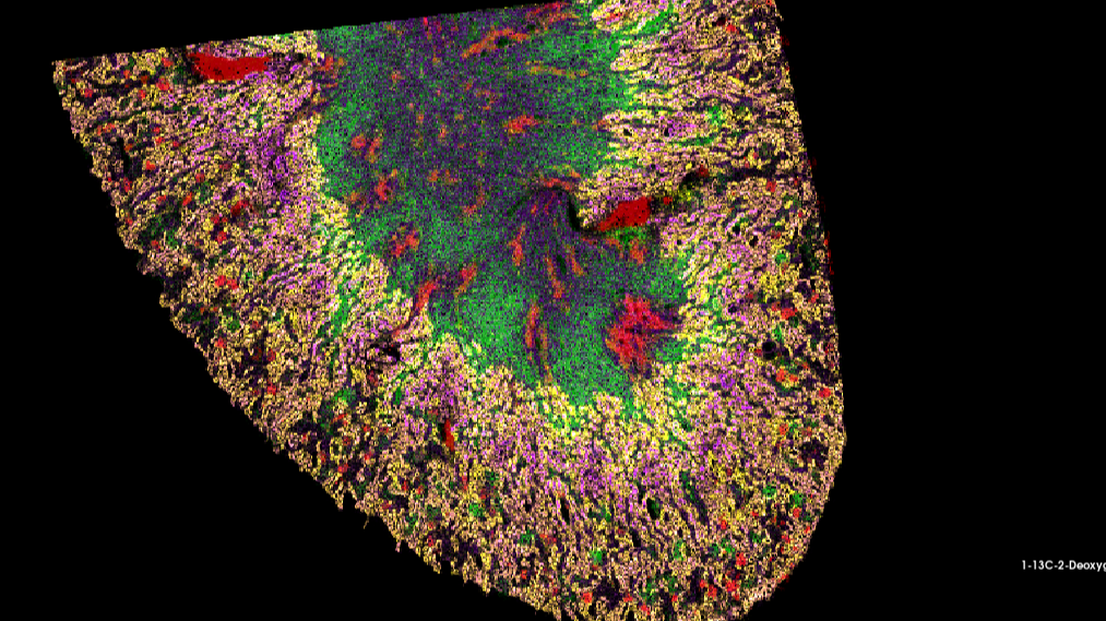 Measuring cell-type specific metabolism in tumors using imaging mass spectrometry