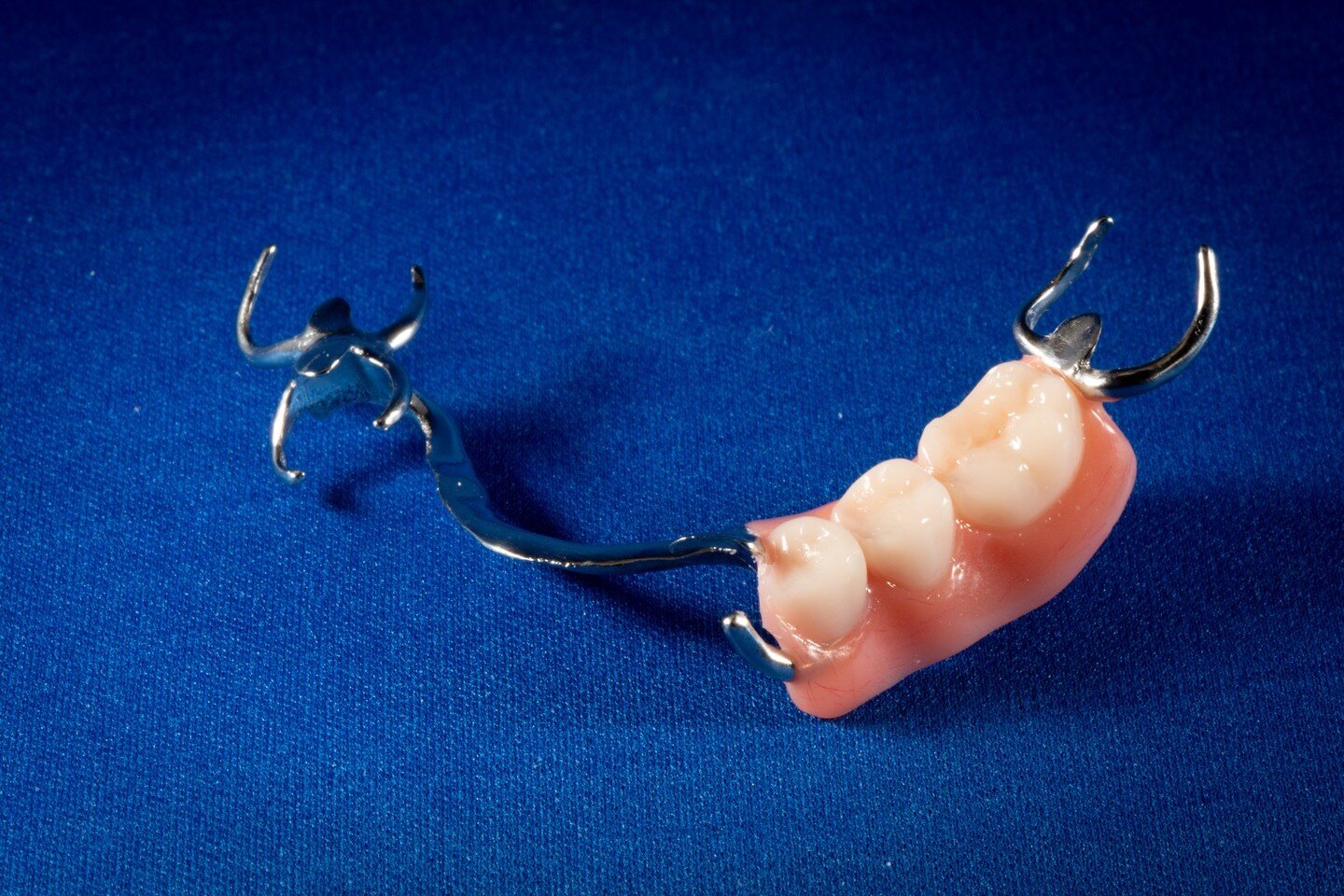 The removable partial denture is a workhorse of dental prostheses.  The metal backbone gives it strength and stability to restore missing teeth without much impact on surrounding tissues.