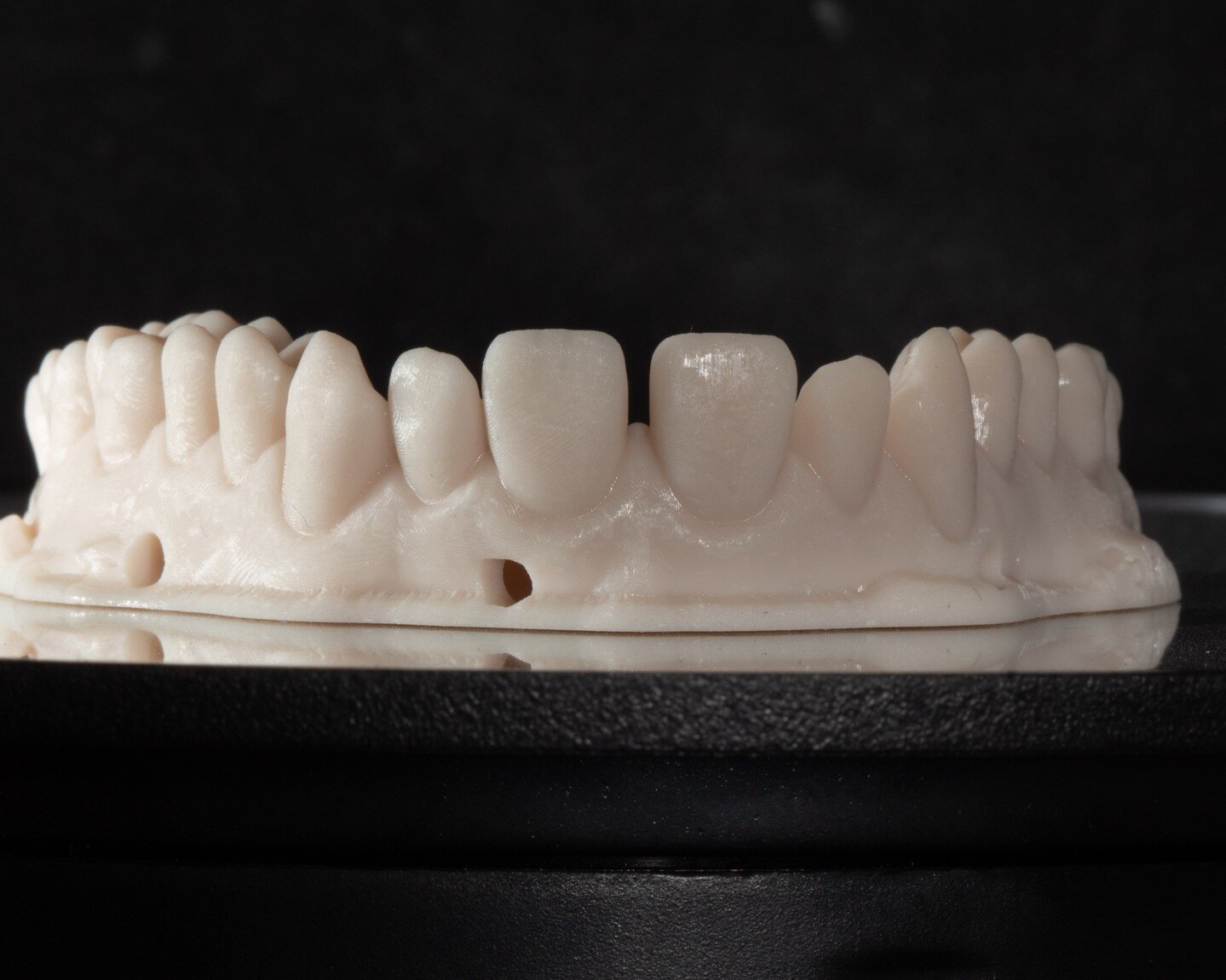 A study wax-up is a proposal for treatment.  This case shows what it would look like if the patient opted for this treatment. 

Sometimes patients like to see and hold their models as they consider treatment.  Sometimes the dentist uses the printed m