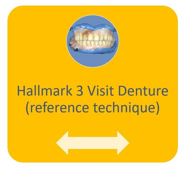 Our 3-visit denture technique is now available for download from our website. 

People commonly ask how a denture technique can be reduced to 3 visits.  No stages are missed; only combined. 

The patient's existing denture (no matter how poorly it fi