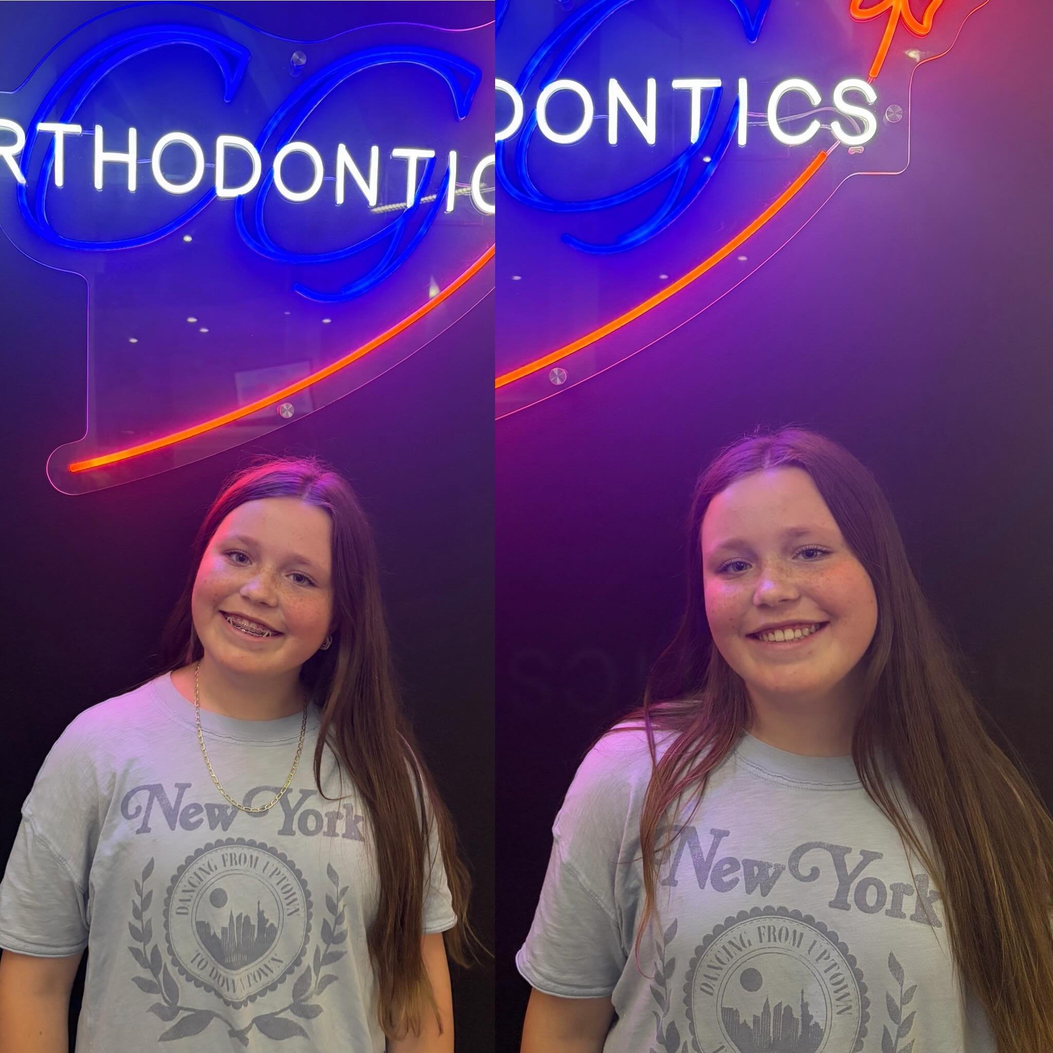 Big day for #remyangeline! After a palette expander and braces and then round 2 of braces, she is finally done and left with a beautiful smile. Of all my children, I know she will be the most diligent with her retainer. 

Thank you @cg_orthodontics f