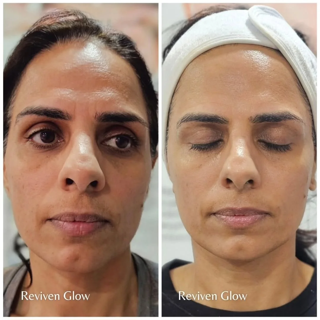 Side-by-side before and after photos of a woman showing her face with the text 'Reviven Glow' underneath each image. The woman has a visible difference in her skin appearance, looking more radiant and smooth in the after photo with her eyes closed, wearing a white headband in the after picture.
