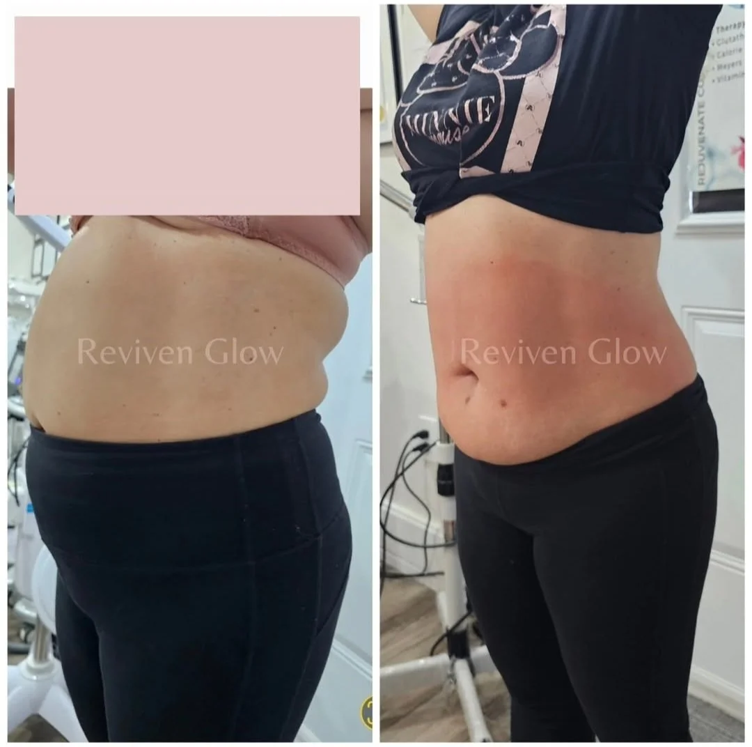 Comparison of a woman's midsection before and after body transformation, showing reduced abdominal fat and improved muscle tone, with a watermark 'Reviven Glow' on both images.