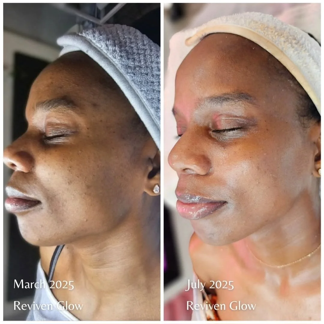 Side-by-side comparison of a woman with smooth, glowing skin. The left side shows her in March 2025 with minimal makeup, and the right side in July 2025 with enhanced glow and makeup. Text on the image says "March 2025, Reviven Glow" on the left and "July 2025, Reviven Glow" on the right.
