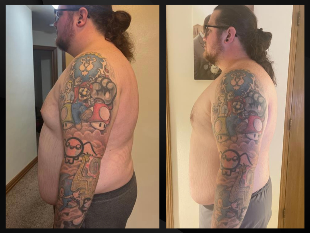 Side-by-side comparison of a man with tattoos on his arm and chest before and after weight loss. The man has long hair tied back, glasses, and a beard, and is shirtless in both images.