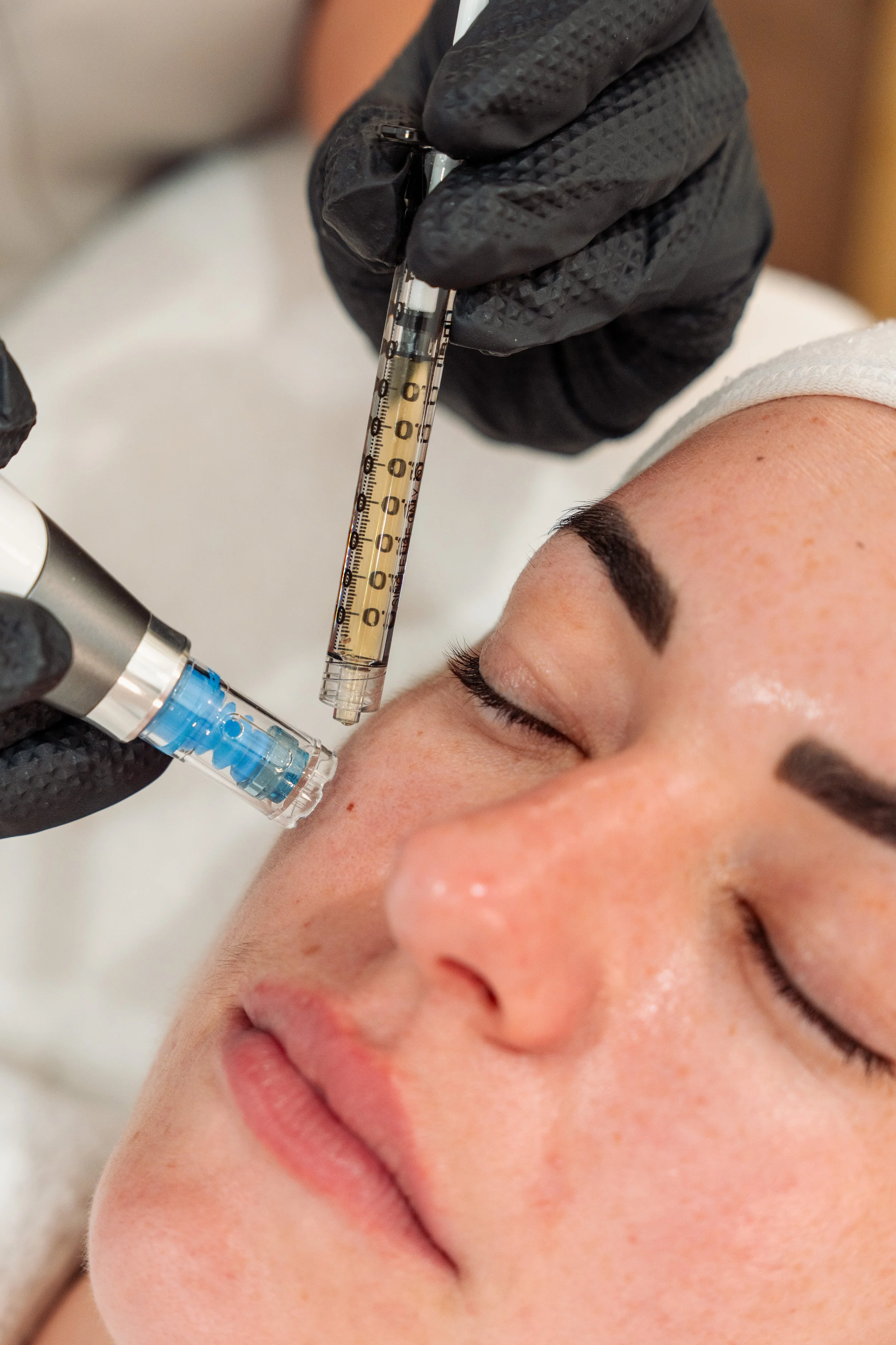 A person receiving a facial treatment with a syringe and a glass vial, likely for cosmetic or dermatological purposes, while resting with eyes closed.