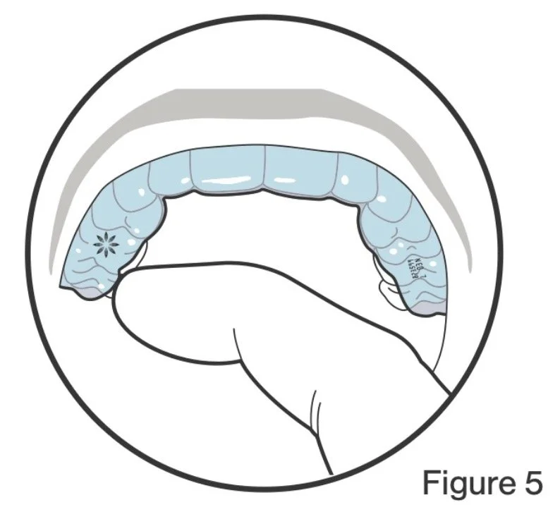A drawing of a hand applying toothpaste onto a toothbrush inside a mouth, with the brush touching the upper teeth.