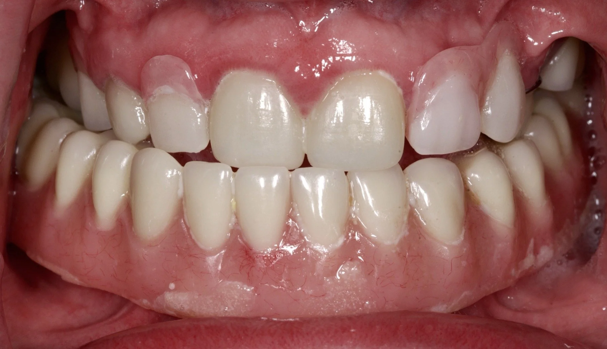 Before condition