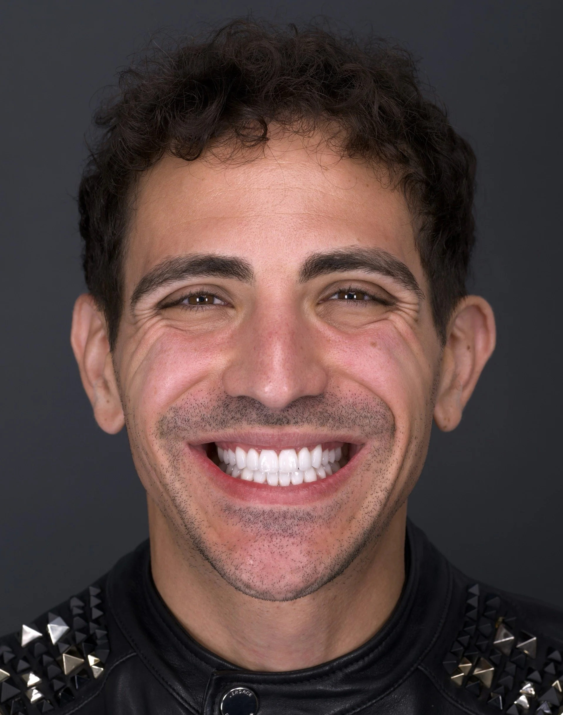 Porcelain Veneers by Jeremy Heldt, DDS in Newport Beach