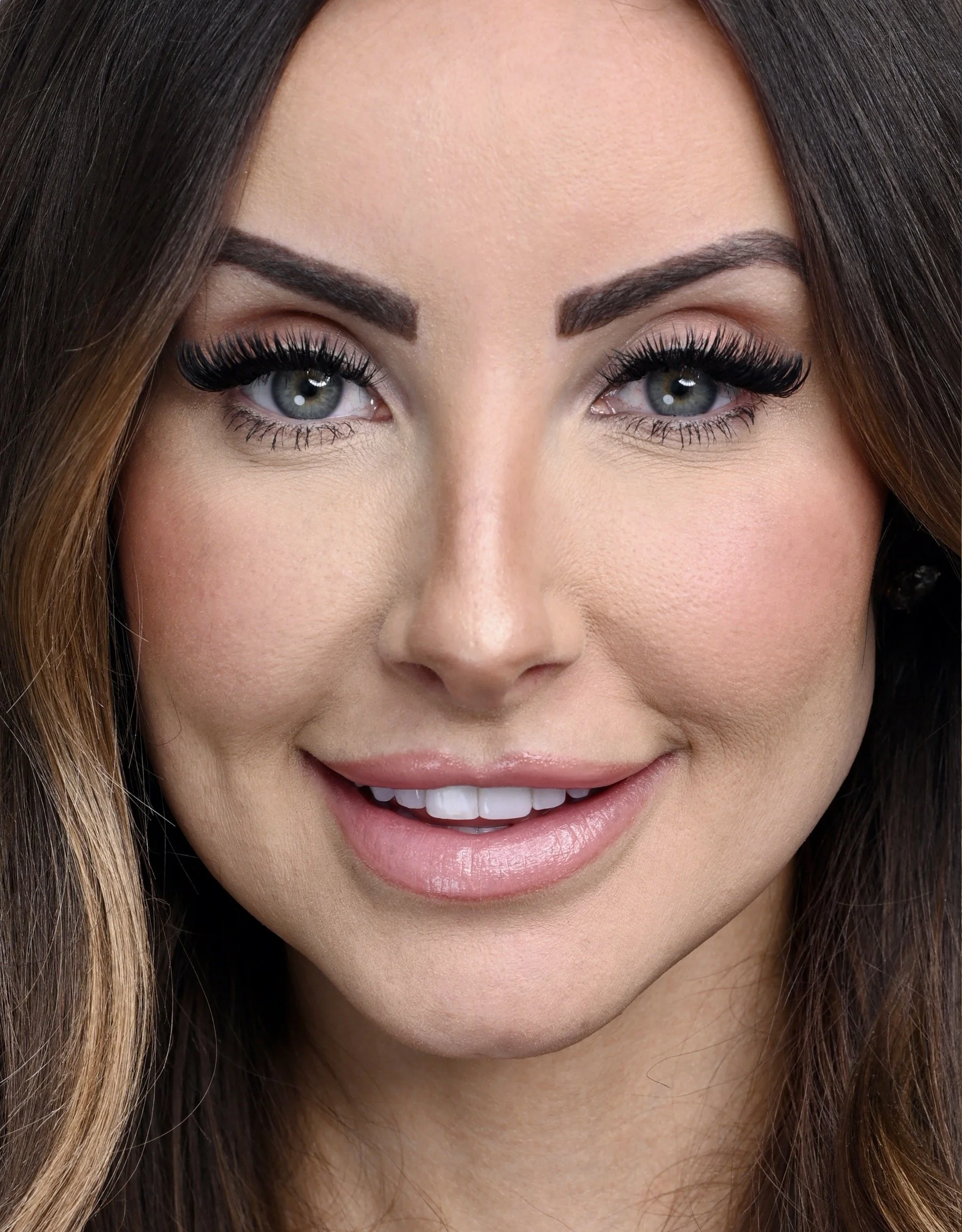 Porcelain Veneers by Jeremy Heldt, DDS in Newport Beach