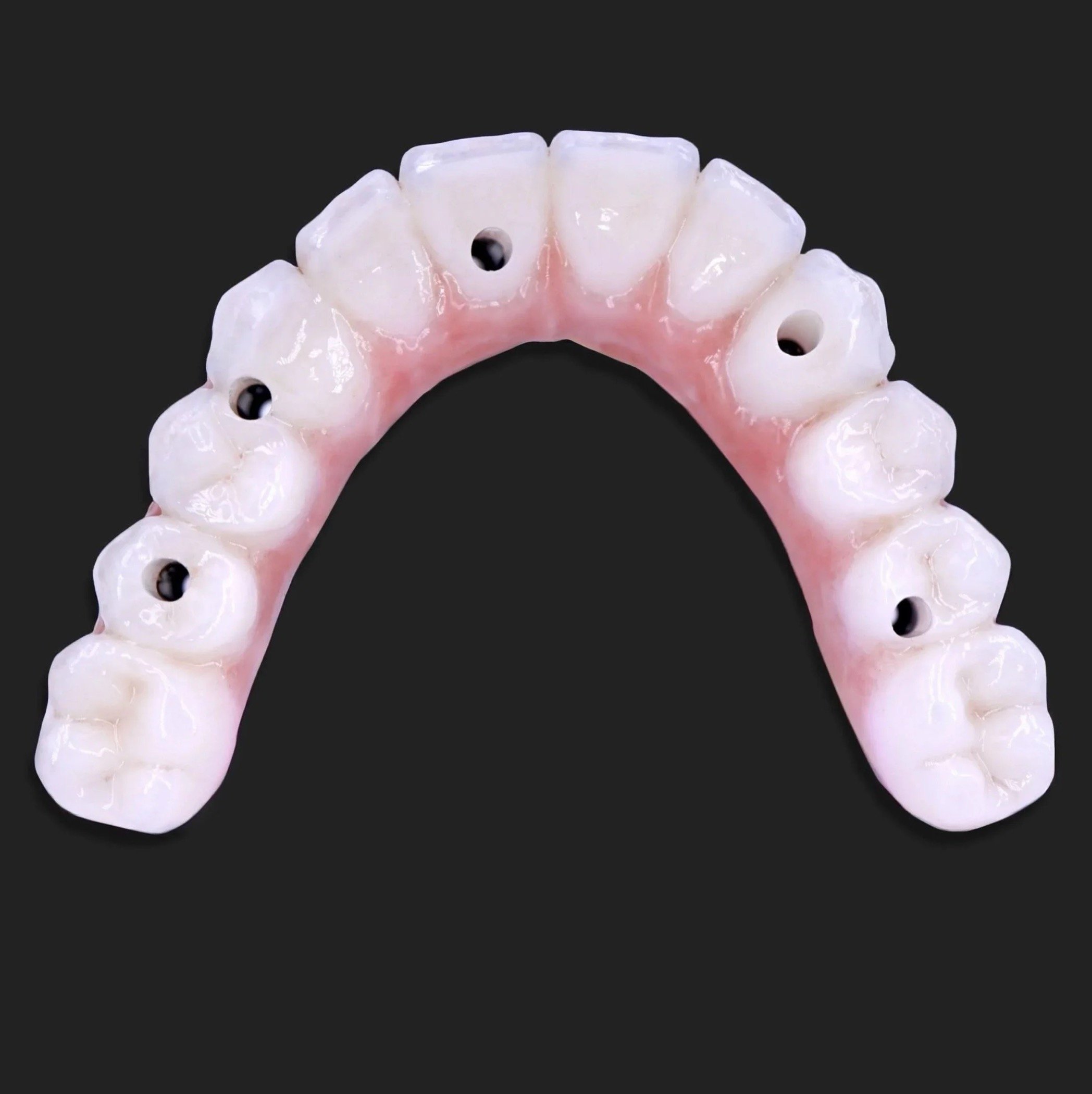 Dental Implants by Jeremy Heldt, DDS in Newport Beach