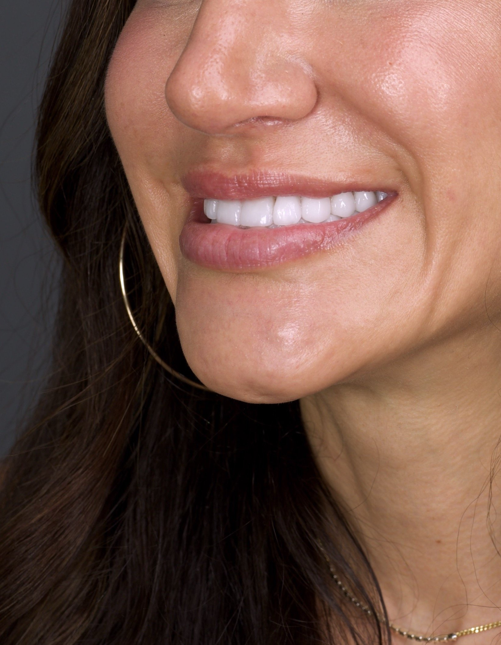 Dental Implants by Jeremy Heldt, DDS in Newport Beach