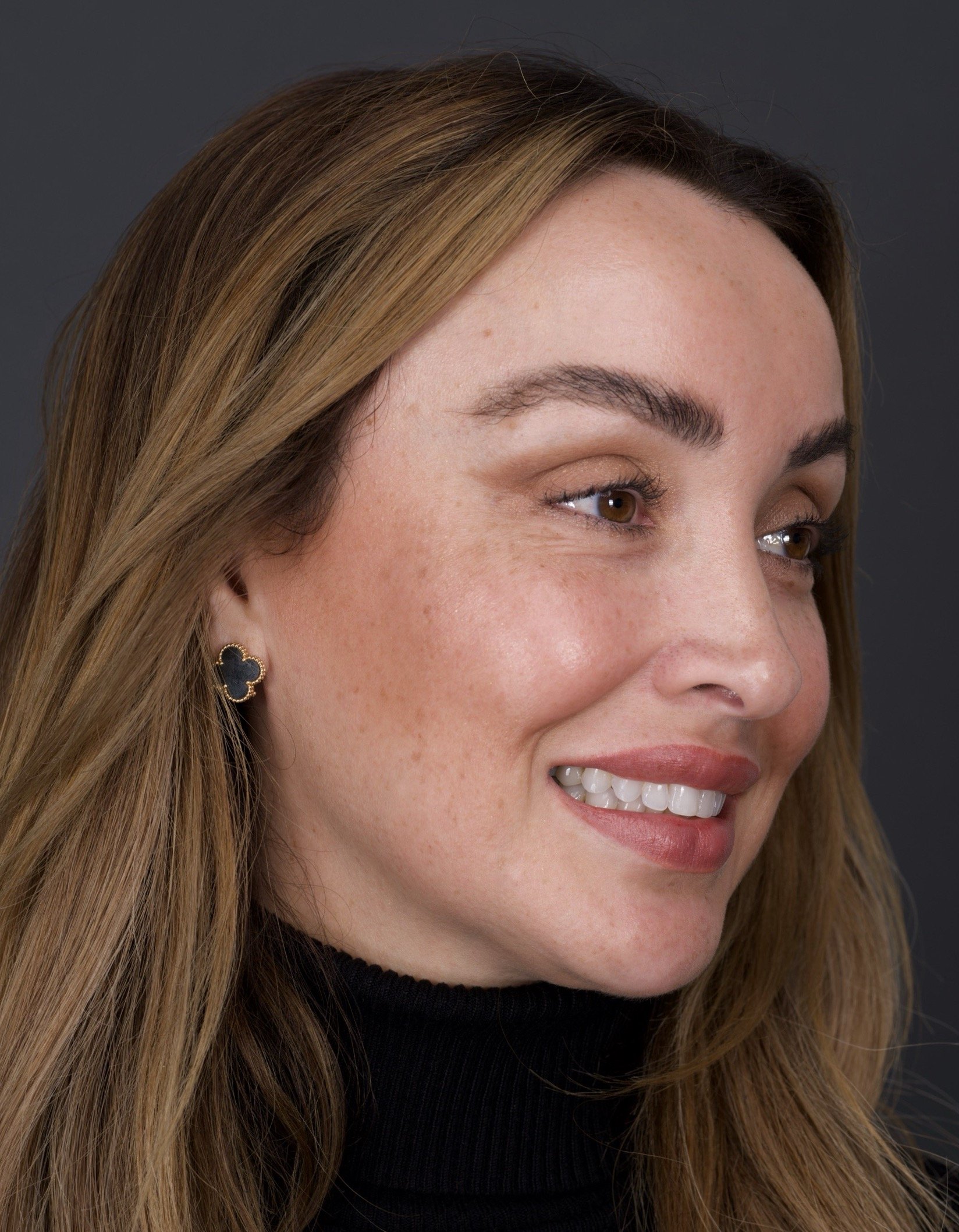 Invisalign by Jeremy Heldt, DDS in Newport Beach