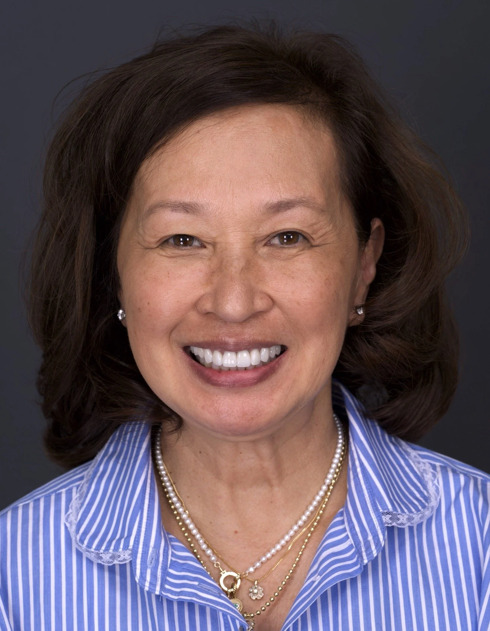 Veneers by Jeremy Heldt, DDS in Newport Beach