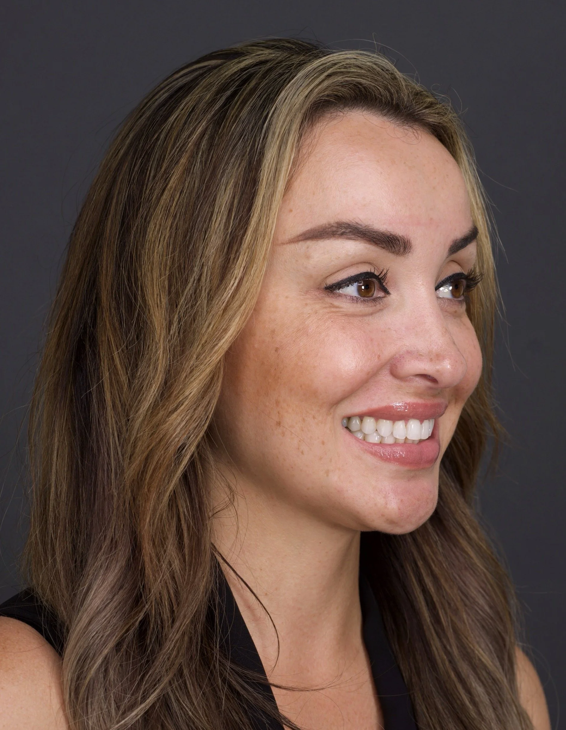 Invisalign by Jeremy Heldt, DDS in Newport Beach