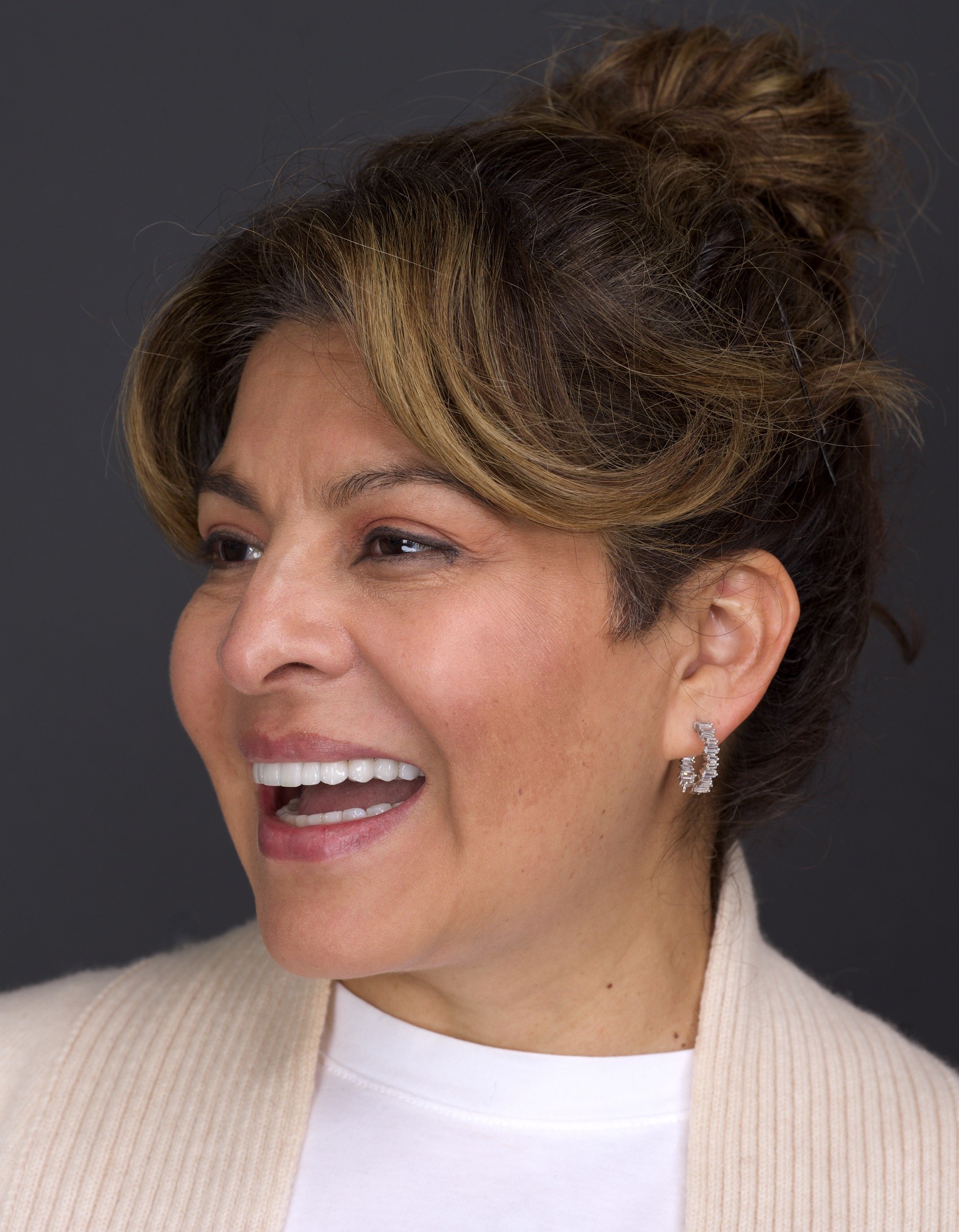 Dental Implants by Jeremy Heldt, DDS in Newport Beach