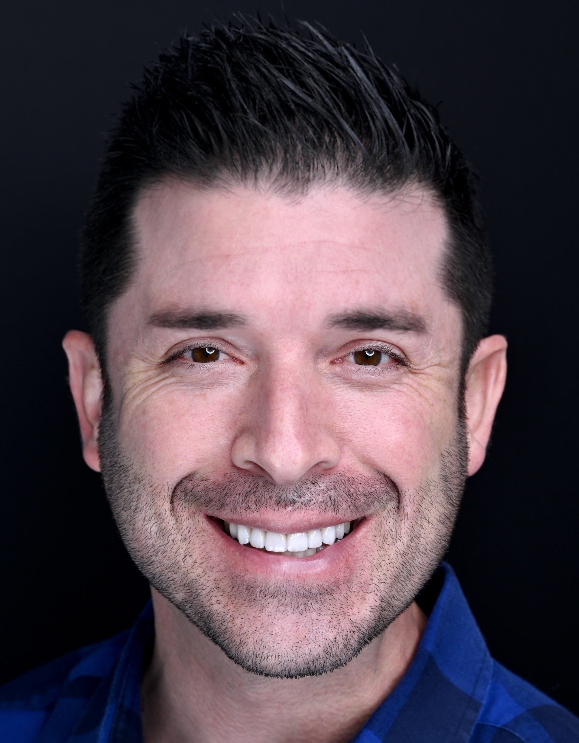 Porcelain Veneers by Jeremy Heldt, DDS in Newport Beach