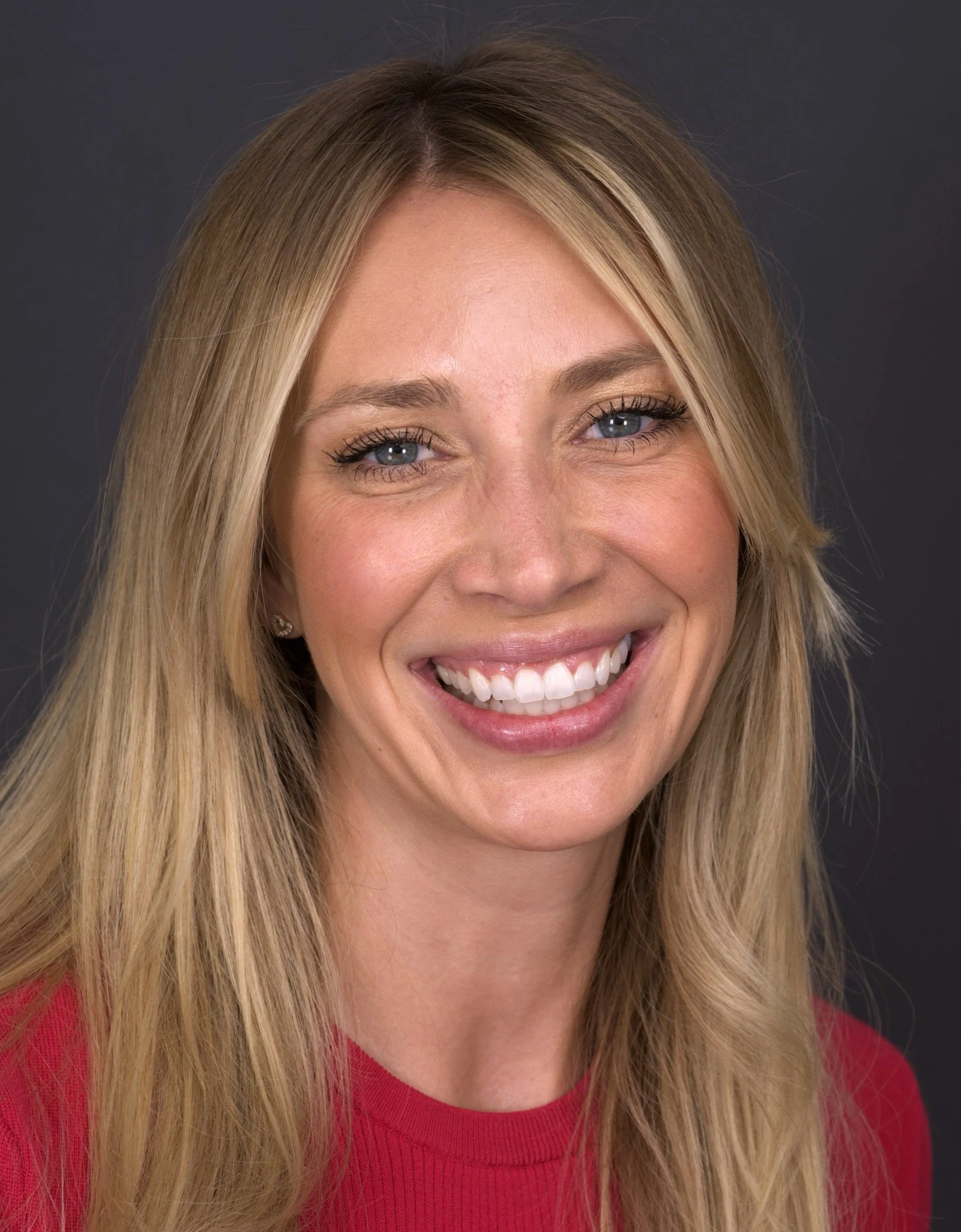 Veneers by Jeremy Heldt, DDS in Newport Beach