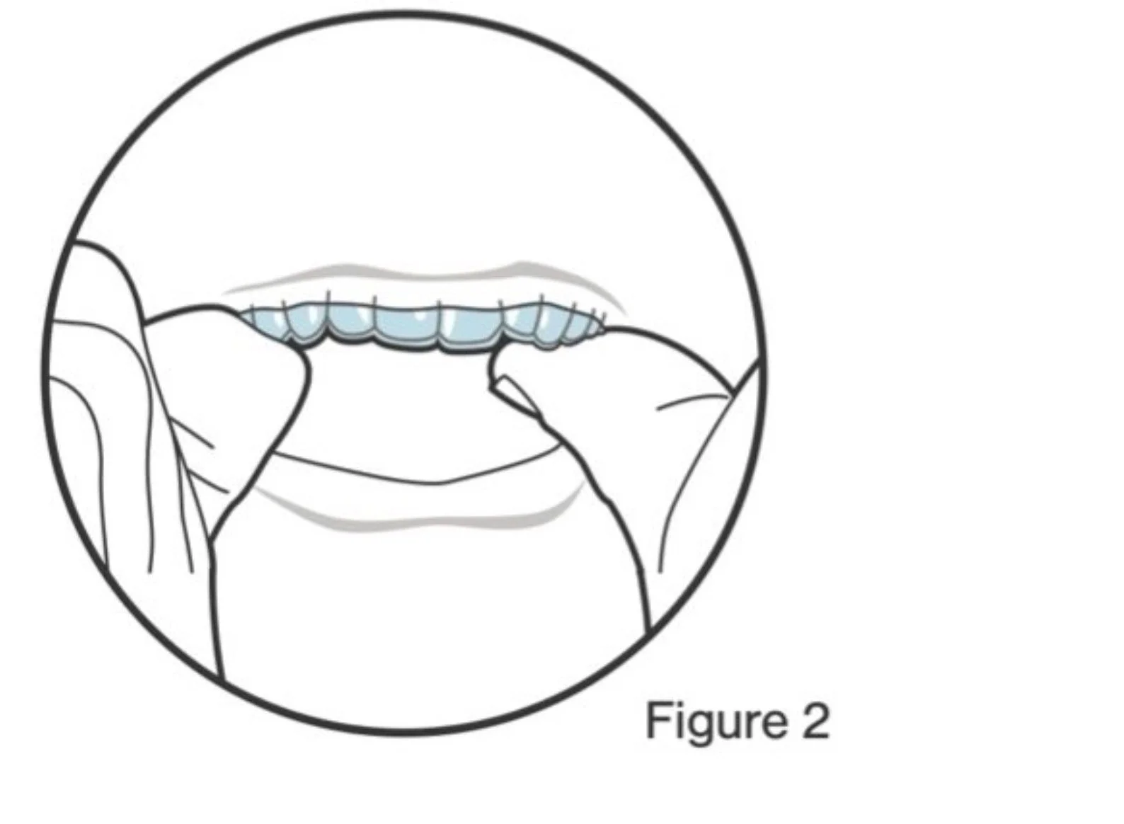 A person placing dental floss between their upper front teeth.