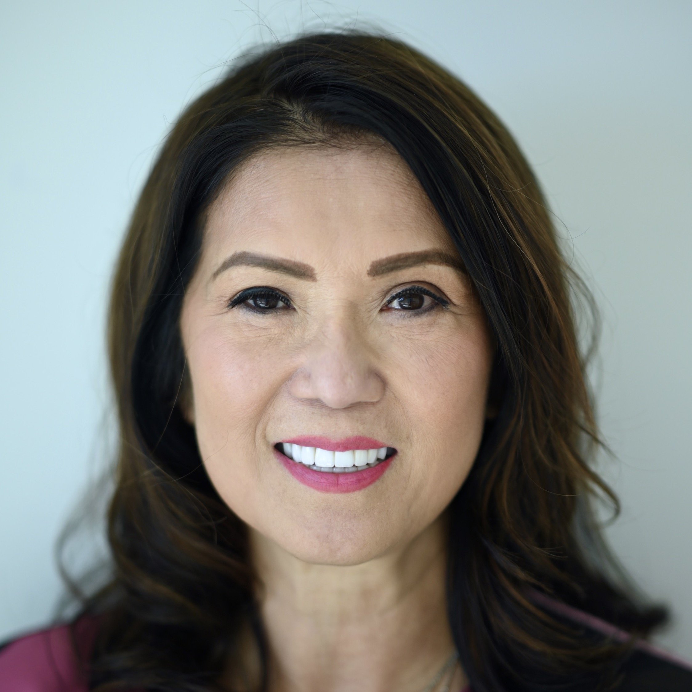 2 Immediate Implants + Bridge